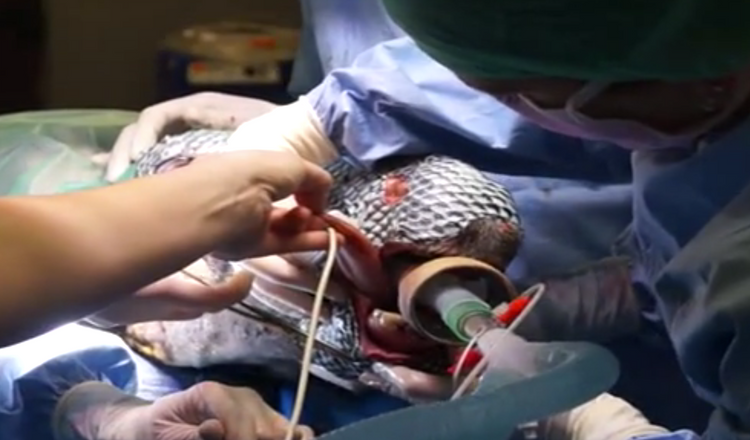 Från operationen när fiskskinnet syddes fast som skydd över skadorna.